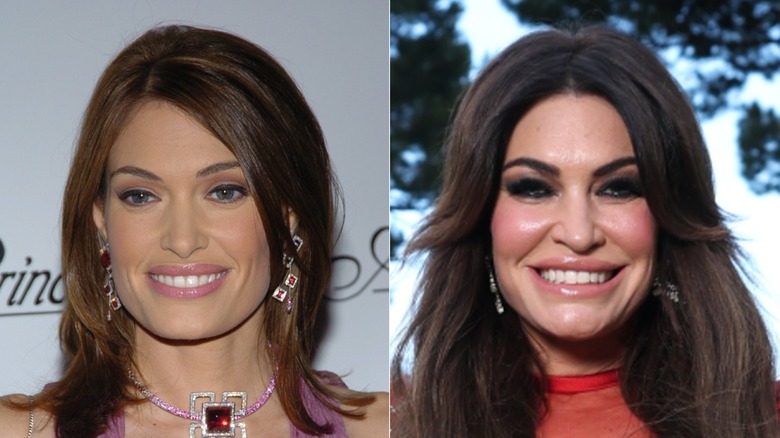 Kimberly Guilfoyle antes y después de su transformación facial MAGA