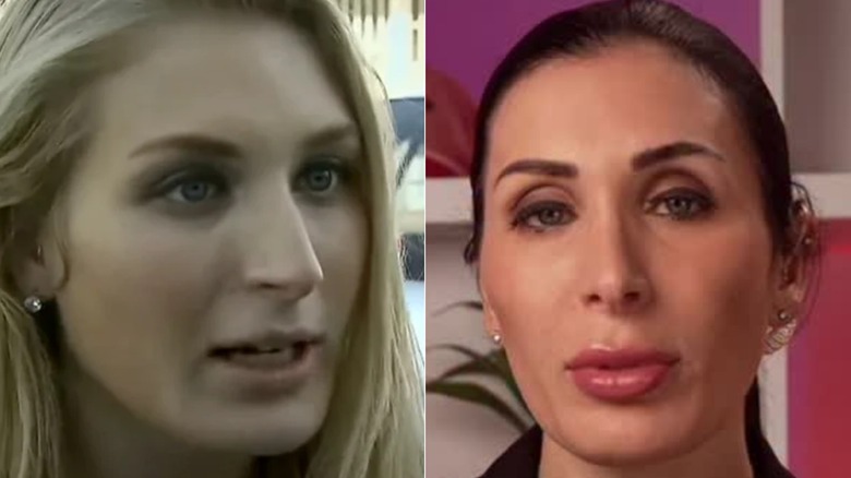 Laura Loomer antes y después de su transformación facial MAGA