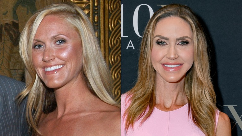 Lara Trump antes y después de su transformación de rostro