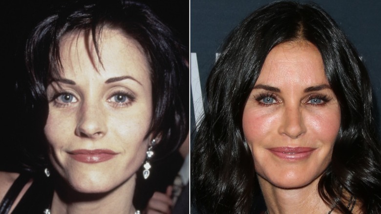Courteney Cox en 1994 y 2015 después de hacerse un relleno facial y de labios