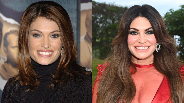 Una foto de antes y después que muestra la transformación facial de Kimberly Guilfoyle