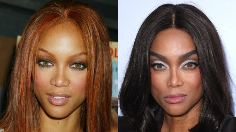 Tyra Banks antes y después de la cirugía plástica
