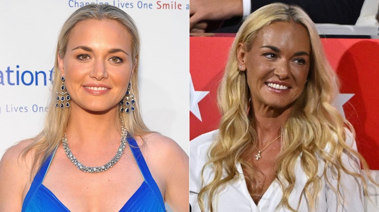 Vanessa Trump en 2010 y 2024