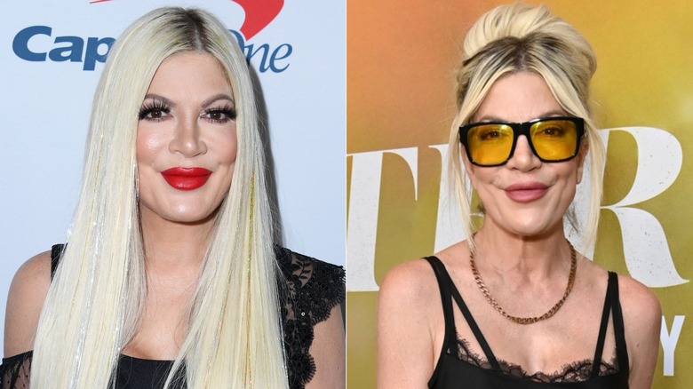 Fotos una al lado de la otra que muestran la pérdida de peso facial de Tori Spelling