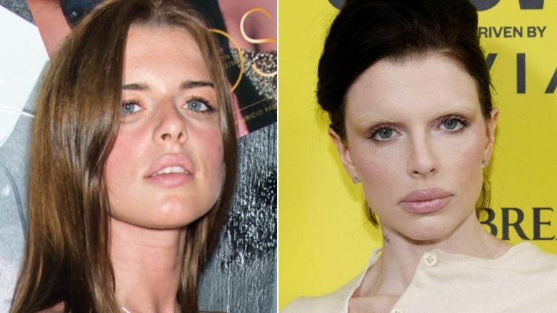 Fotos de antes y después de la cirugía plástica de Julia Fox