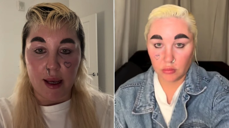 Fotos una al lado de la otra que muestran la pérdida de peso de Amanda Bynes