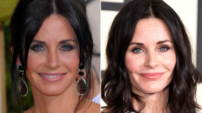 Fotografías una al lado de la otra que muestran el rostro de Courteney Cox con y sin rellenos