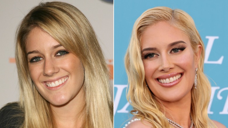 Heidi Montag en 2006 y 2025
