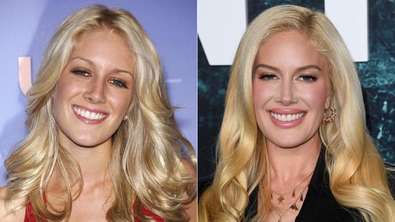 Heidi Montag luciendo natural en 2007 y con mejoras cosméticas en 2011