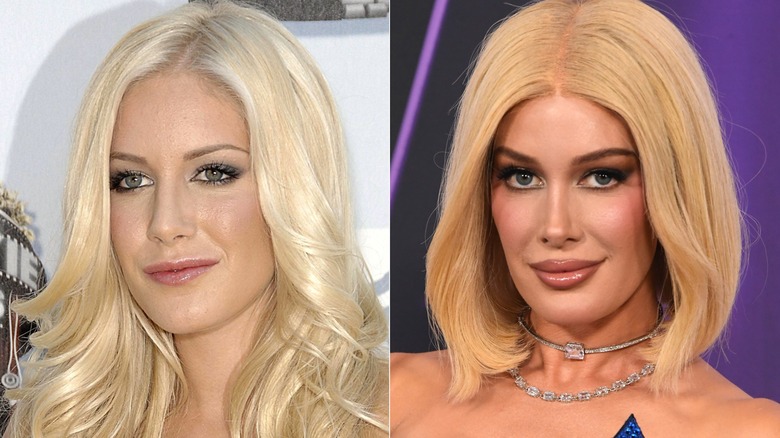 Heidi Montag luce más natural en 2008 y con el rostro arreglado en 2025