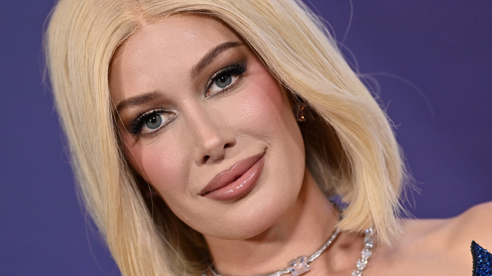 Las fotos de antes y después de Heidi Montag muestran su dramática transformación facial